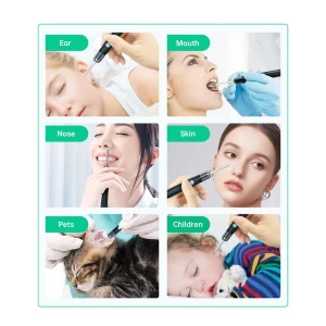 Ear wax removal kit y8 with wi-fi, 2mp camera,1080p, ip67, black Thumbnail 3