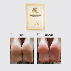 Профилактический крем для ног со змеиным жиром, 30 г Thumbnail 6