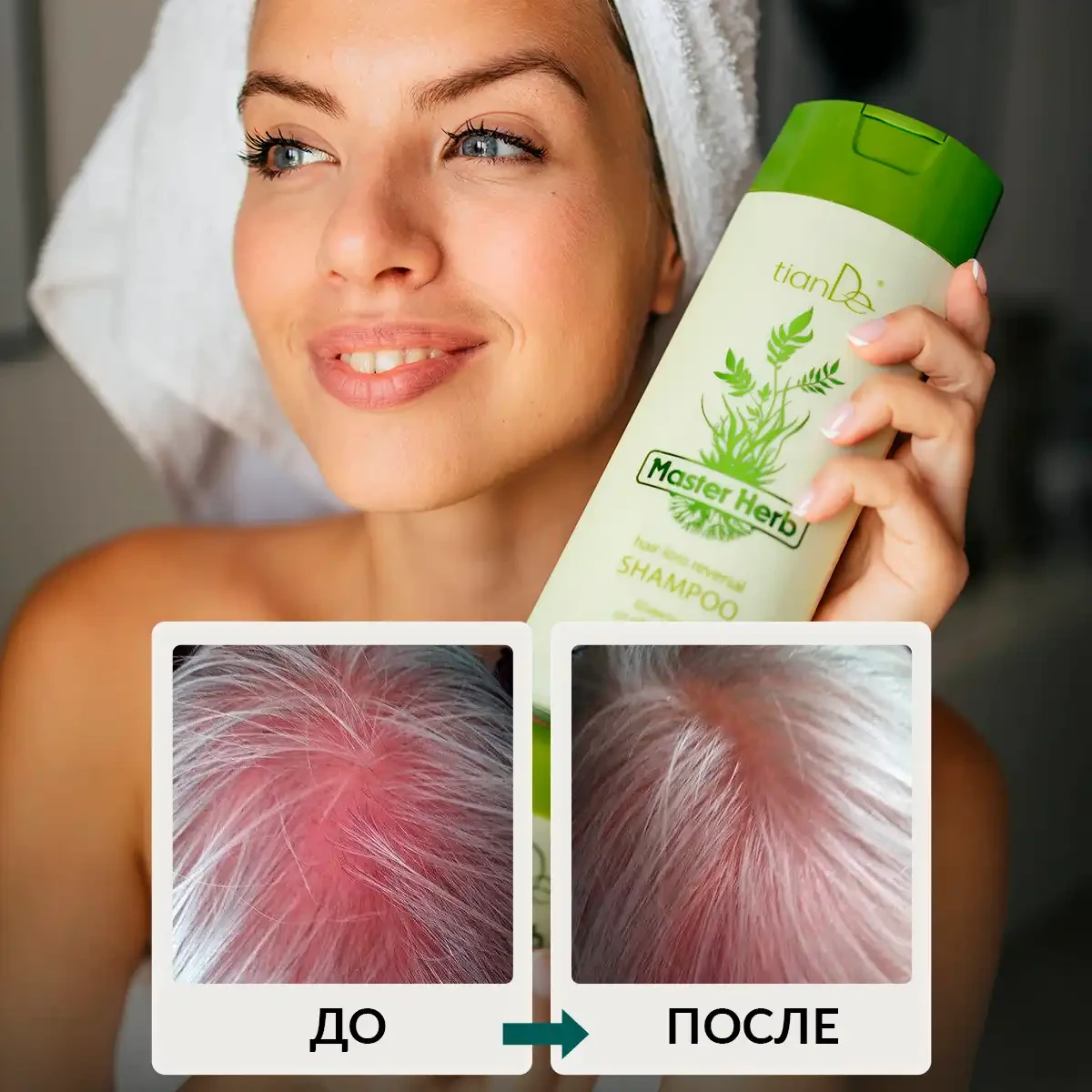 Шампунь от облысения, 420 мл 8