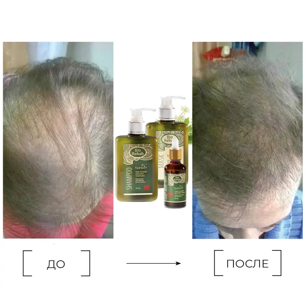 Șampon-activator de creștere a părului, 250 g 9