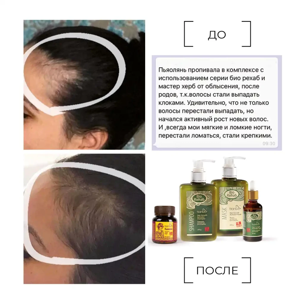 Șampon-activator de creștere a părului, 250 g 10