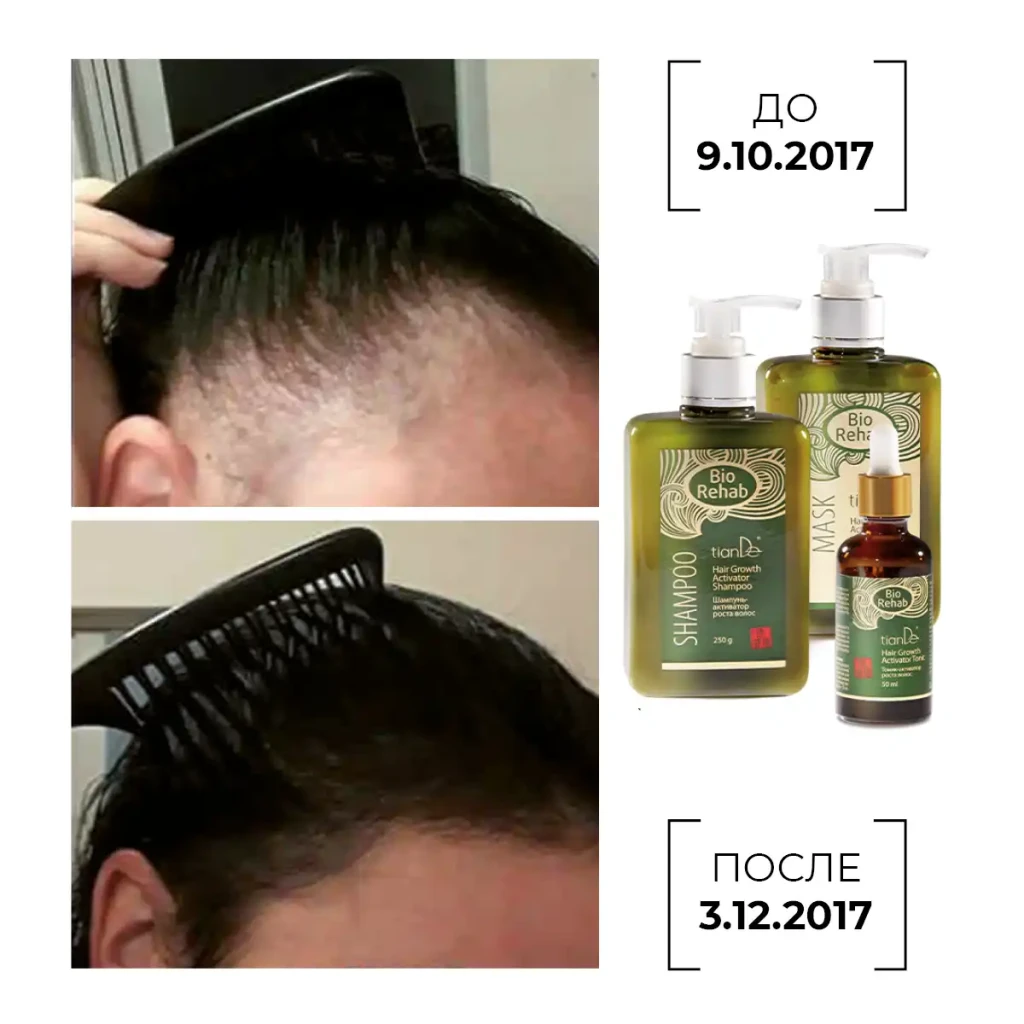Șampon-activator de creștere a părului, 250 g 8