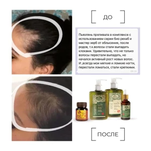 Șampon-activator de creștere a părului, 250 g Thumbnail 10