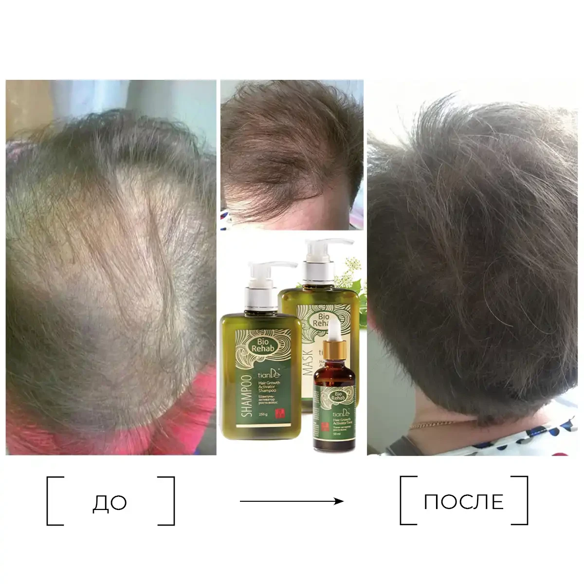 Mască-activator de creștere a părului, 250 g 10