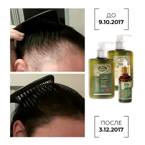 Mască-activator de creștere a părului, 250 g Thumbnail 8