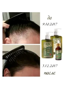 Mască-activator de creștere a părului, 250 g Thumbnail 8