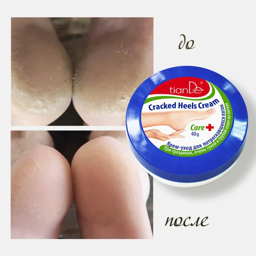 Cremă de îngrijire pentru călcâie crăpate 6